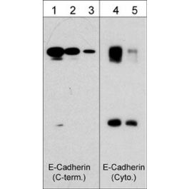 E Cadherin Phospho Regulation Antibody Sampler Kit