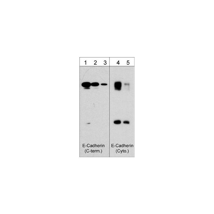 E-Cadherin Phospho-Regulation Antibody Sampler Kit